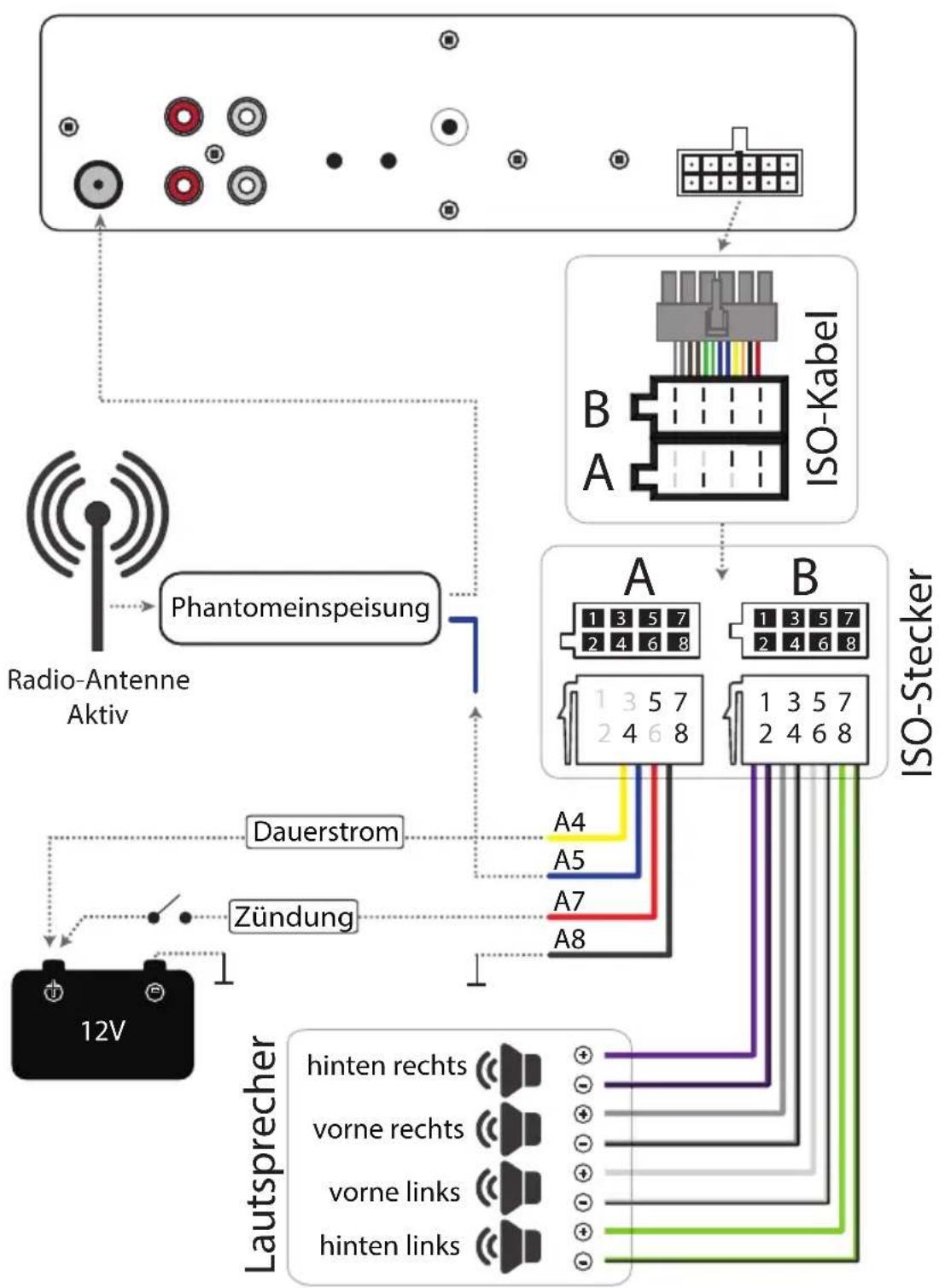Xomax XM-RSU253BT - Montagezubehör entfernen - 2