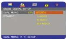 Xomax XM-DTSBN905 - Audio setup - 6