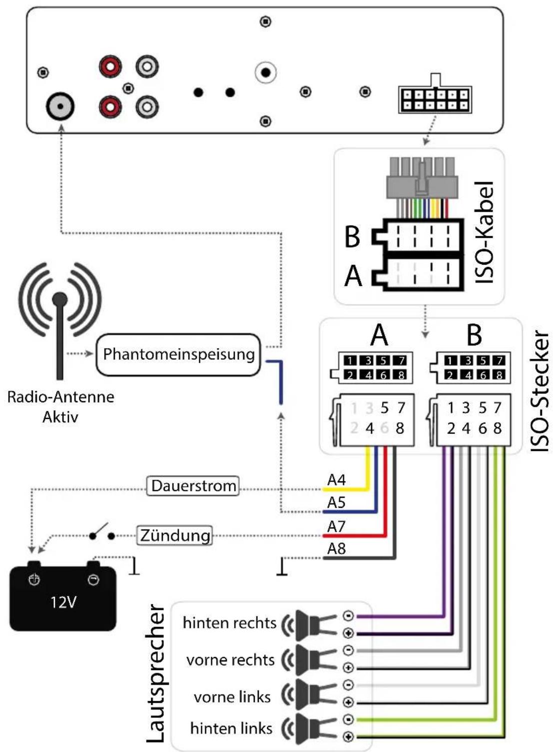 Xomax SP-403M Super - Montagezubehör entfernen - 2