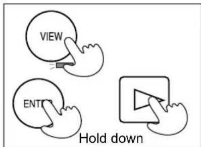 VIEW ENT Hold down