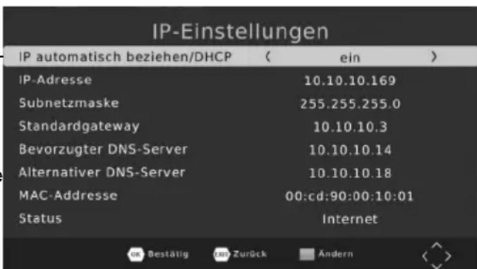 XORO HRS 2670 LAN - IP-Einstellungen (Nur bei Verbindungsart "LAN" verfügbar) - 1