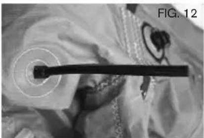Cabrinha Drifter - REPAIRING LEADING EDGE BLADDERS - 12