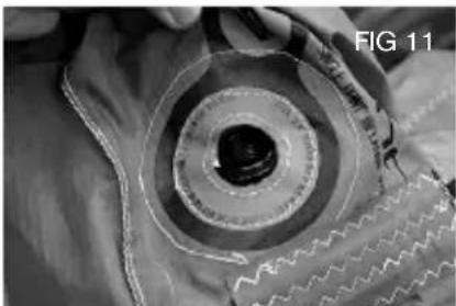 Cabrinha Drifter - REPAIRING LEADING EDGE BLADDERS - 11