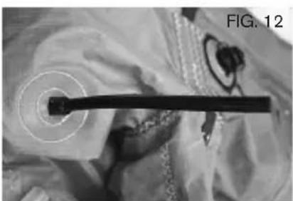Cabrinha Apollo - REPAIRING LEADING EDGE BLADDERS - 12