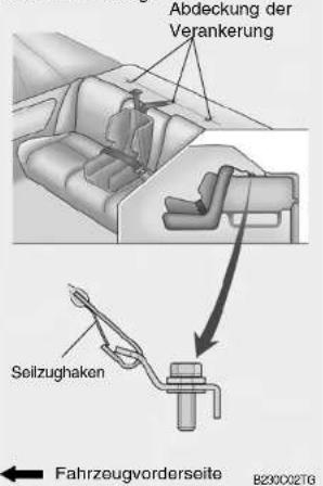Abdeckung der Verankerung Seilzughaken Fahrzeugvorderseite B230002TG