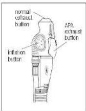 Tusa Active Purge Assisit - APA inflator unit - 1