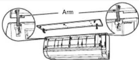 Arm