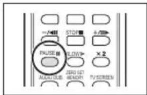 CANON ZR400 - Press the PAUSE II button on the wireless controller to begin dubbing. - 1