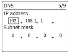 Audisse Netbox - Manual network configuration - 1