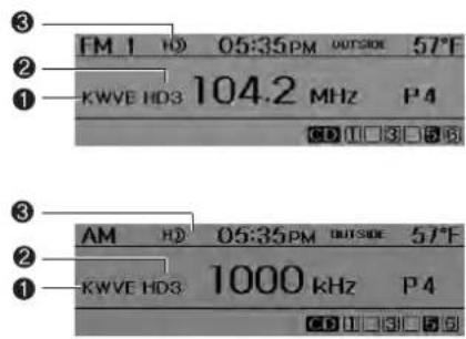 HYUNDAI Sonata Turbo (2011) - Radio display while receiving a digital HD Radio™ - 1