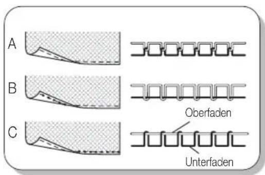 MIO STAR M 10 Stitch - Vorbereitung - 1