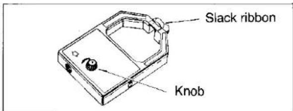 Slack ribbon Knob