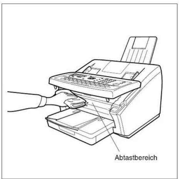 PANASONIC Panafax UF-6300 - Reinigen der Dokumentenabtastung - 2