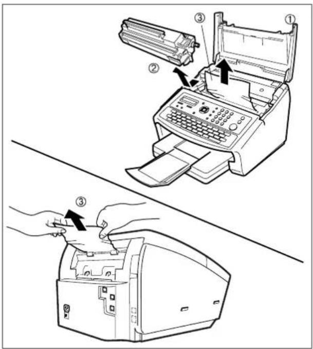 PANASONIC Panafax UF-6300 - Stau des Empfangspapiers beseitigen - 2