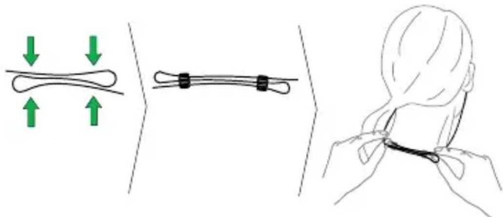 Medical illustration showing a medical procedure with force arrows and a close-up of a patient's neck position.