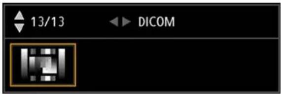 13/13 DICOM