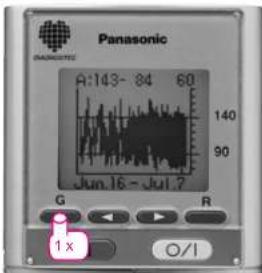 PANASONIC EW3041 - Ihre Blutdruckschwankungen sichtbar. maßgebend für Ihre Blutdruck-Beurteilung. - 1
