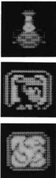 Three pixelated grayscale images showing abstract shapes and patterns, no text or symbols present.