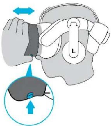 Diagram illustrating a medical procedure on the head with labeled parts and directional arrows indicating movement or force.