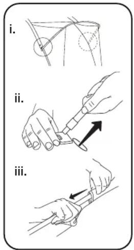i. ii. iii.