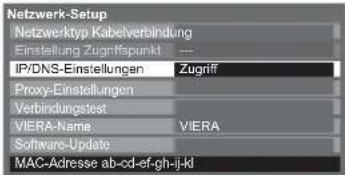 PANASONIC Viera TX-L32GF22 - Netzwerkeinstellungen für die LAN-Kabelverbindung - 3