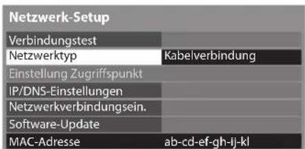 PANASONIC Viera TX-P46G30J - Wählen Sie [Netzwerktyp] und stellen Sie auf [Kabelverbindung] ein - 1