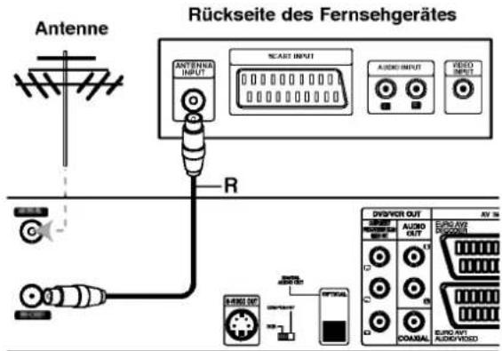 LG RC6800 - RF-Koaxialverbindung - 1