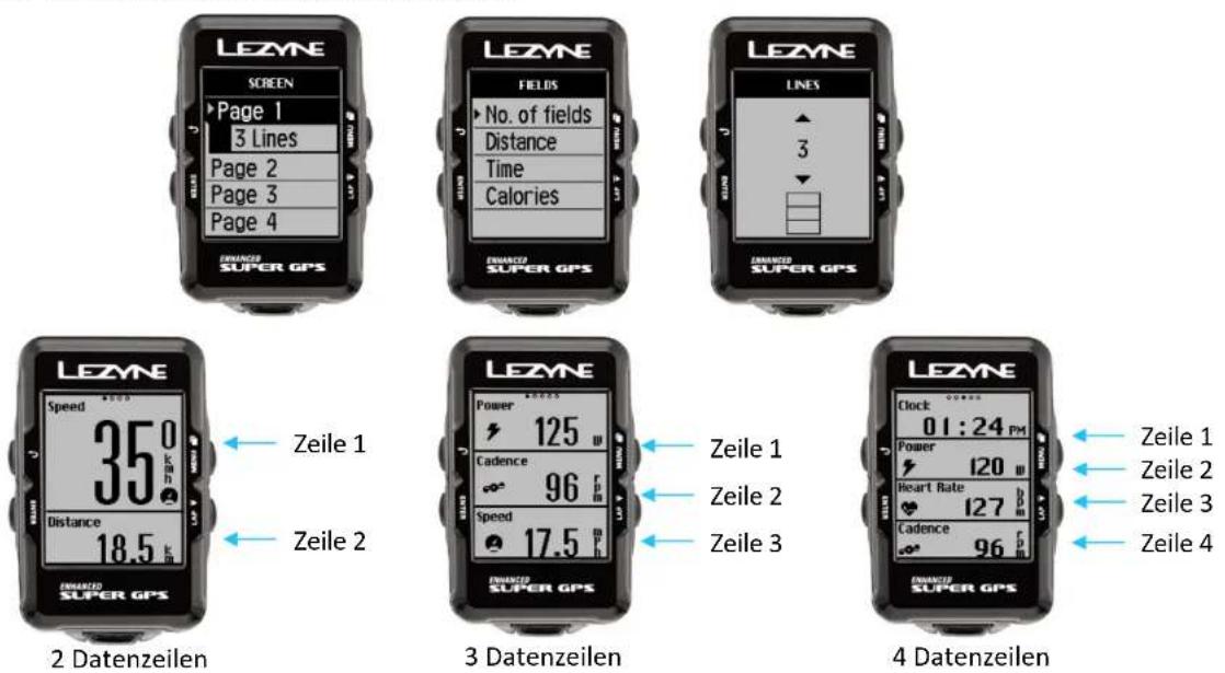 Lezyne Macro - Seite einrichten - 1