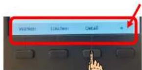 Mitel 6867i - Softkeys (Funktionstasten) - 2