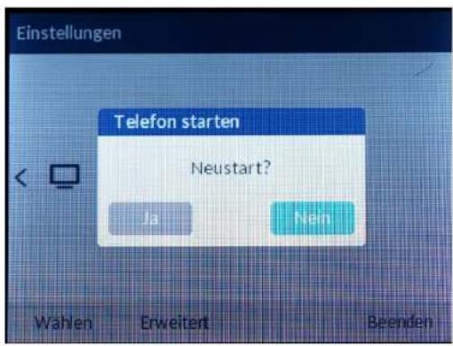 Mitel 6867i - Klicken Sie auf die Auswahltaste - 1