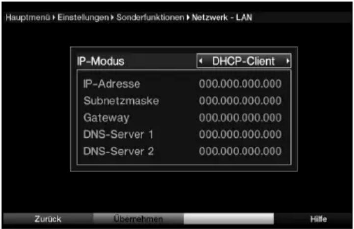 Telestar TELEDIGI 4 HD+ - LAN - Netzwerkeinstellungen - 1