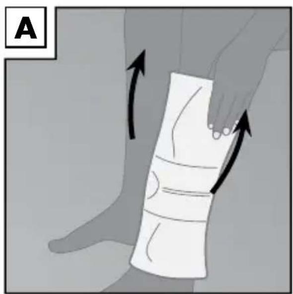 Sensiplast IAN 90365 - Anlegen der Bandage - 1