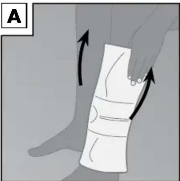 Sensiplast IAN 90365 - Applying the brace - 1