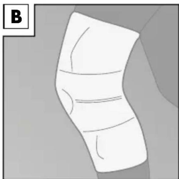 Sensiplast IAN 113019 - Applying the brace - 2