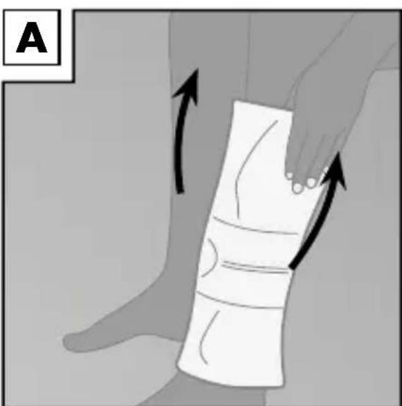 Sensiplast IAN 113019 - Applying the brace - 1