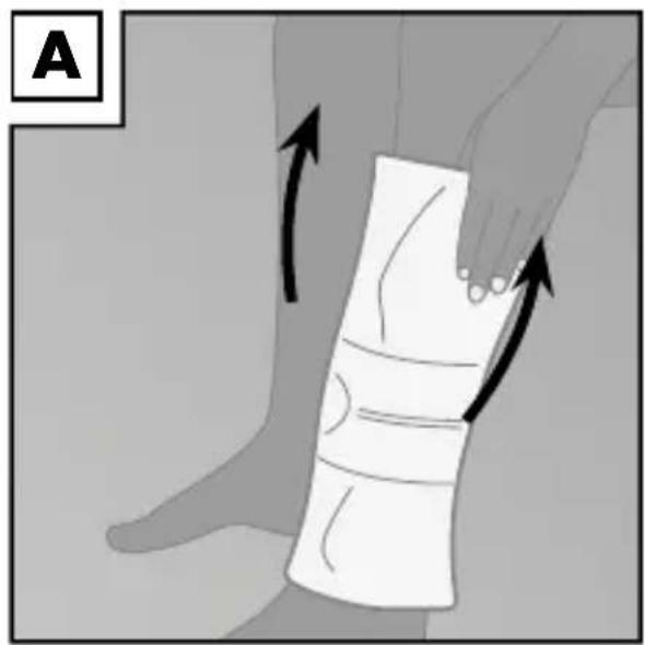 Sensiplast IAN 113019 - Anlegen der Bandage - 1