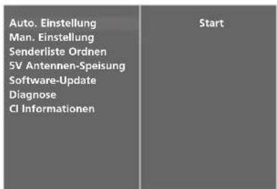 LG 37LF75-ZD.AEU - AUTOMATISCHE PROGRAMMIERUNG (IM DIGITALMODUS) - 3