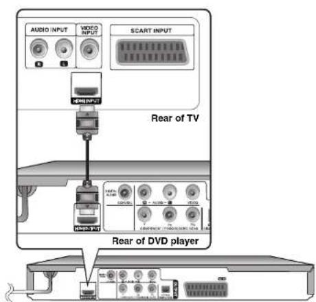 LG DVX592H - HDMI Connection - 1
