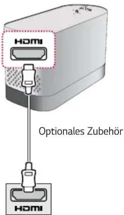 HOMI Optionales Zubehör HOMI
