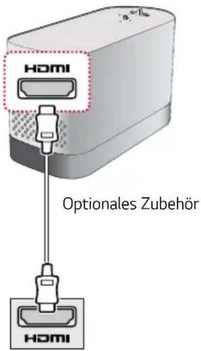 HOMI Optionales Zubehör HOMI