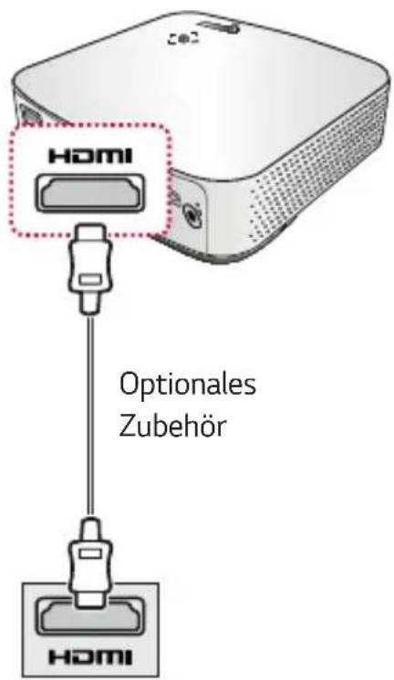HOMI Optionales Zubehör HOMI