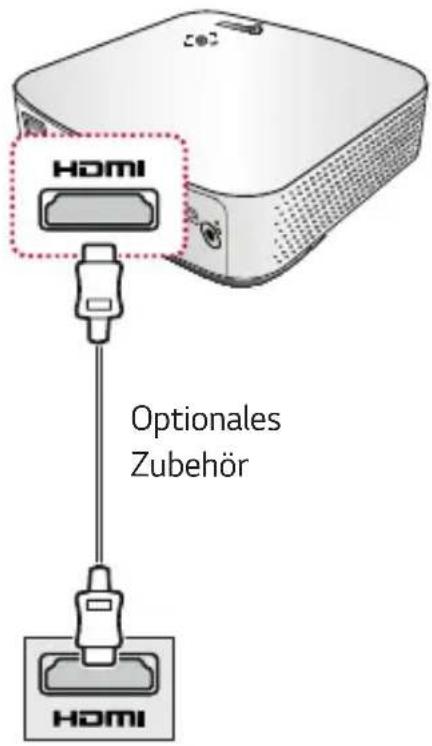 HOMI Optionales Zubehör HOMI