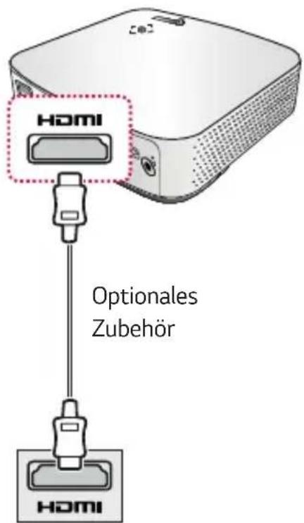 HOMI Optionales Zubehör HOMI