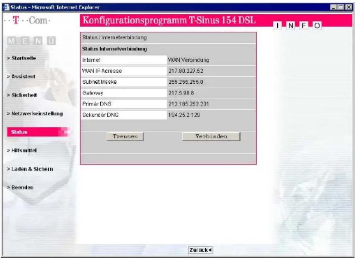 T-Mobile Sinus 154 DSL - Administration des T-Sinus 154 DSL - 1