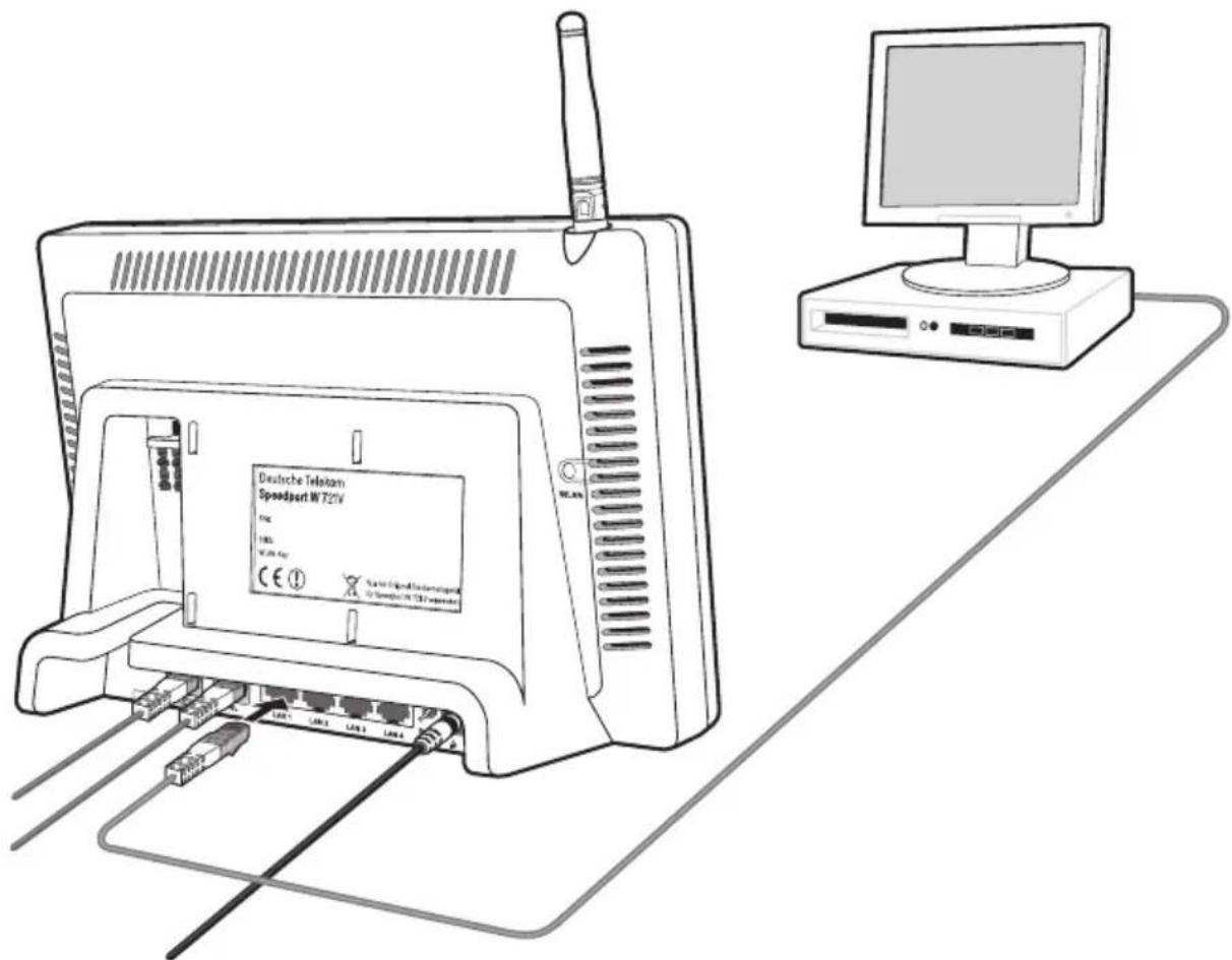 T-Mobile Speedport W 721V - Speedport W 721V am LAN-Anschluss des Computers anschließen - 1