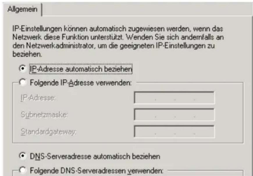 T-Mobile Speedport W 501V - IP-Adresse automatisch beziehen in Windows 2000 - 2