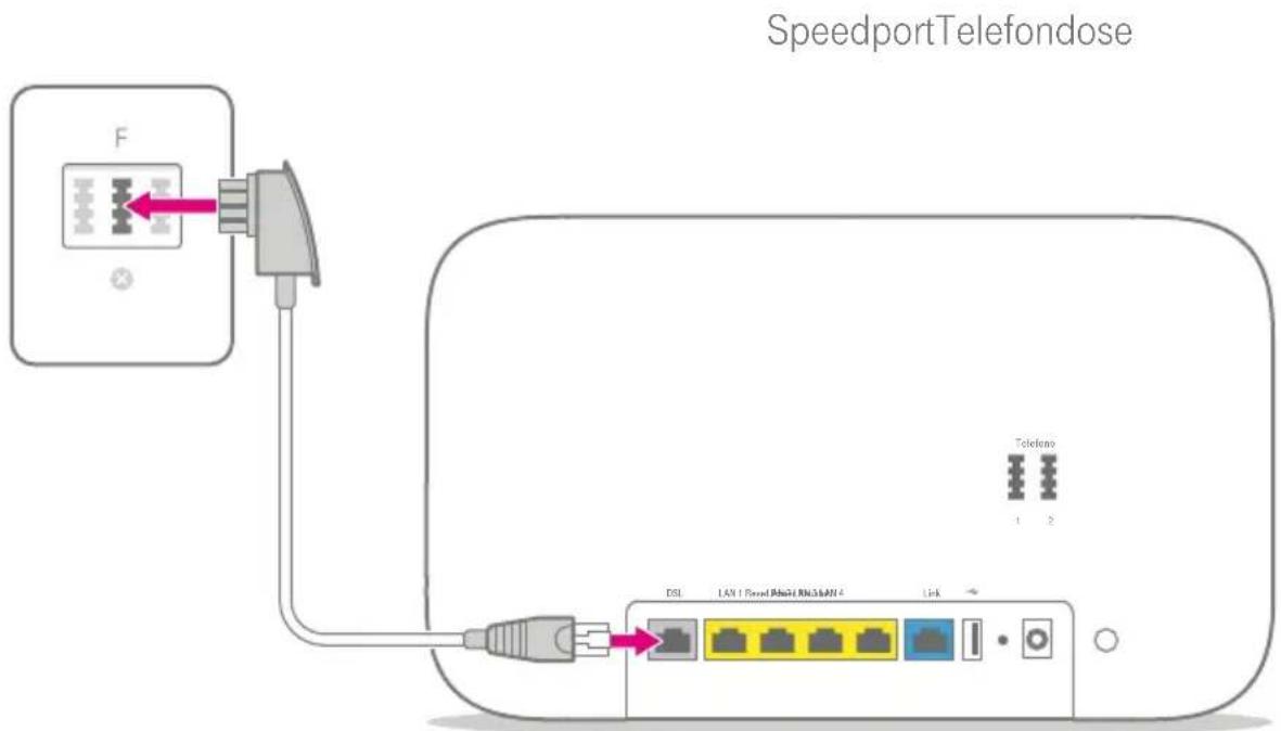 T-Mobile Speedport Smart 2 - DSL-Kabel anschließen - 1