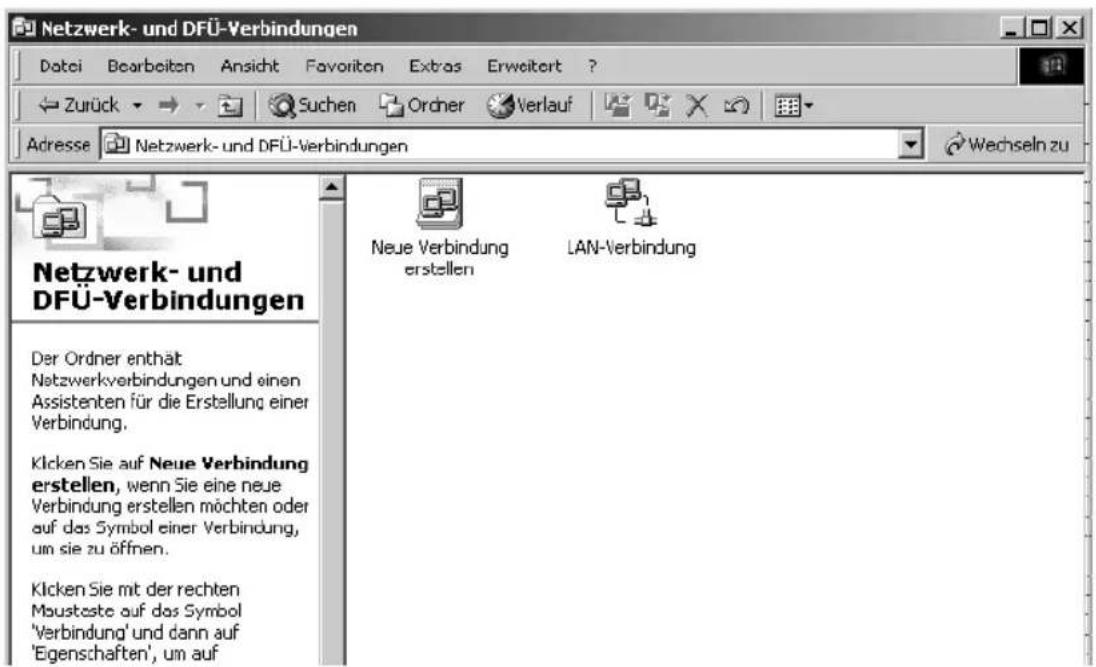 T-Mobile Sinus 154 XR - TCP/IP installieren (Windows® 2000) - 1