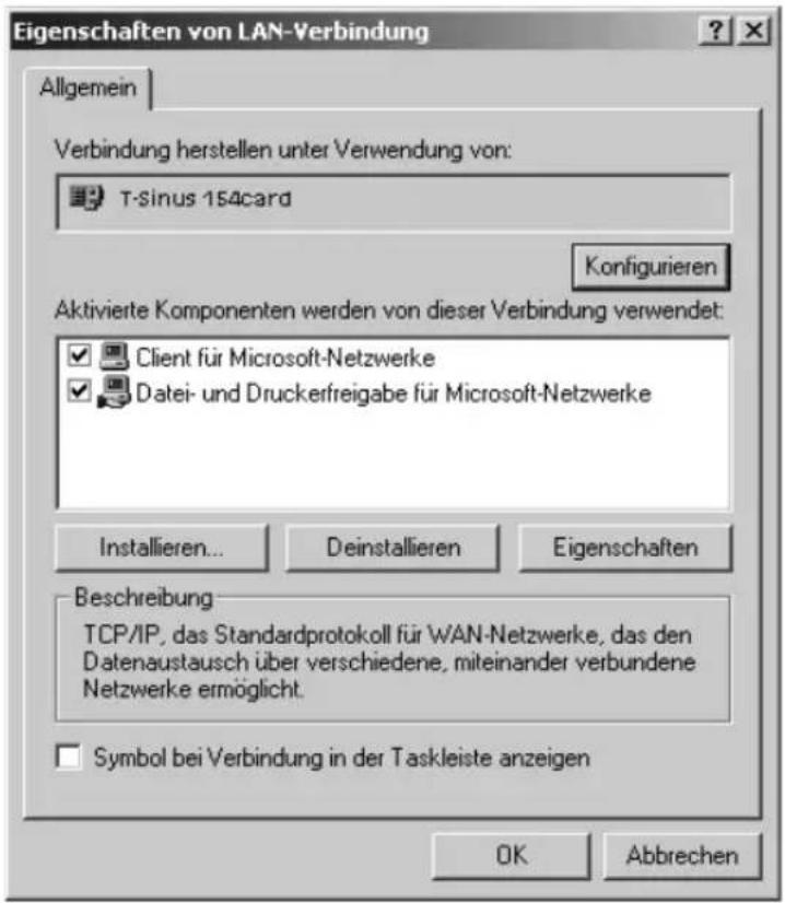 T-Mobile Sinus 154 XR - TCP/IP installieren (Windows® 2000) - 3