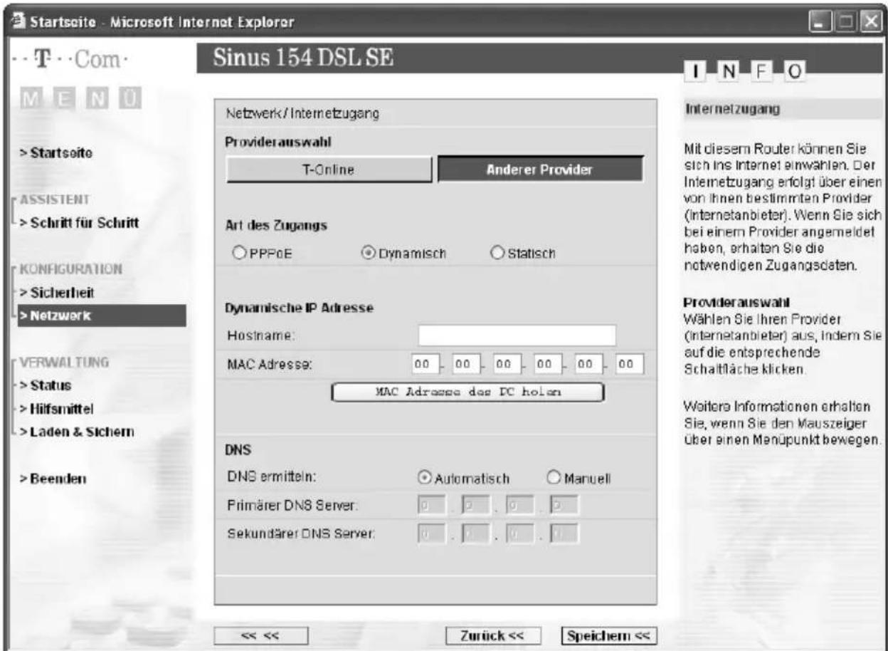 T-Mobile Sinus 154 DSL SE - Internet-Zugang mit dynamischer IP-Adresse - 1